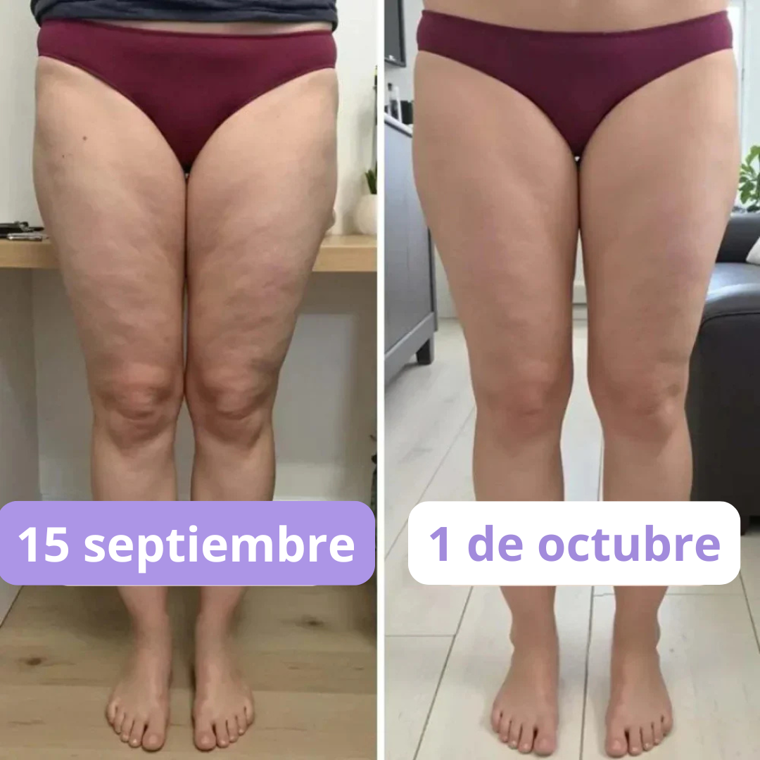Pack 2×1 — Leggings 3D anticelulitis [Paga al recibir — Sin riesgo]
